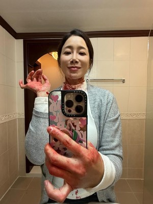 '서프라이즈 하차' 김하영, 3개월 만에…피 칠갑 근황